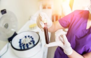 PRP vaginal
